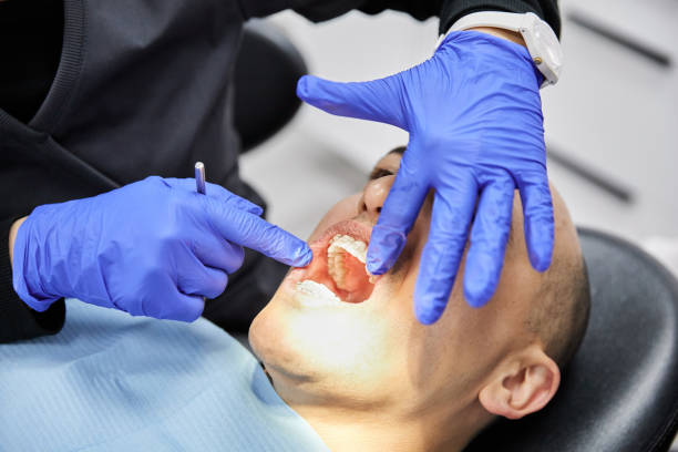 Best Emergency Dentist for Lost Fillings or Crowns in Lapeer, MI